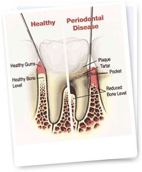 Periodontal Dentistry etobicoke